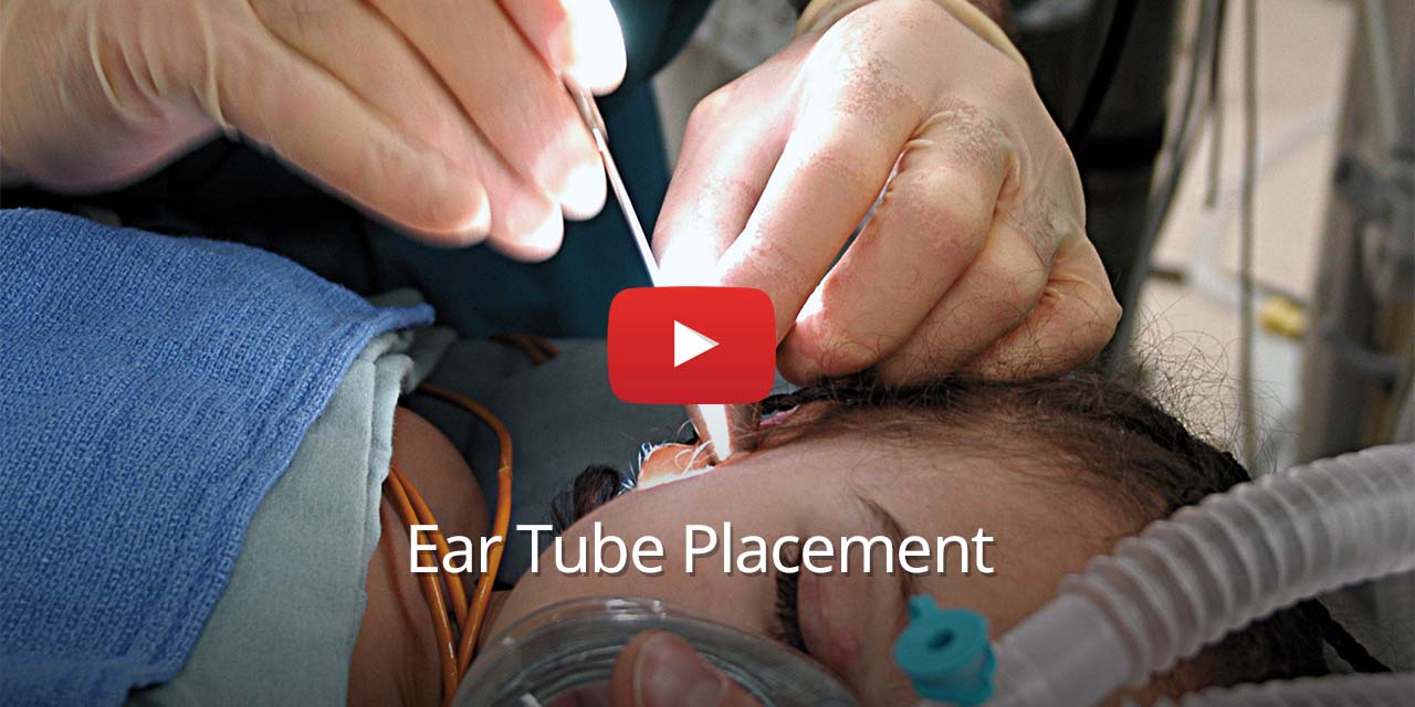Ear Tubes - ENT Associates