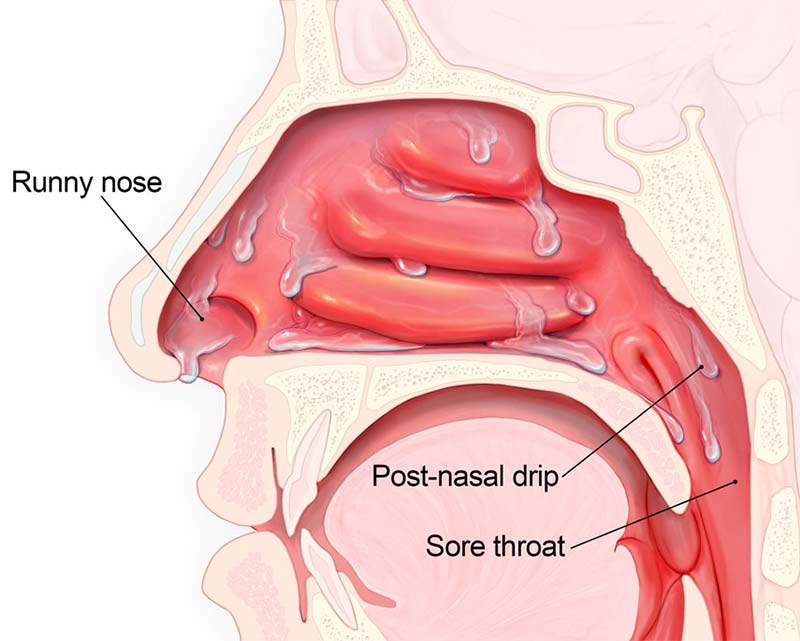 post nasal drip throw up